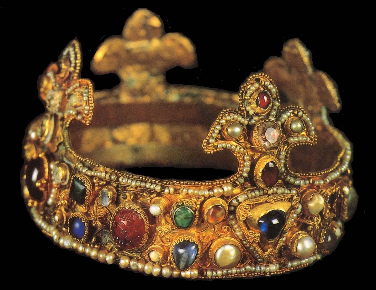 The Crowning Affair: All About Crowns